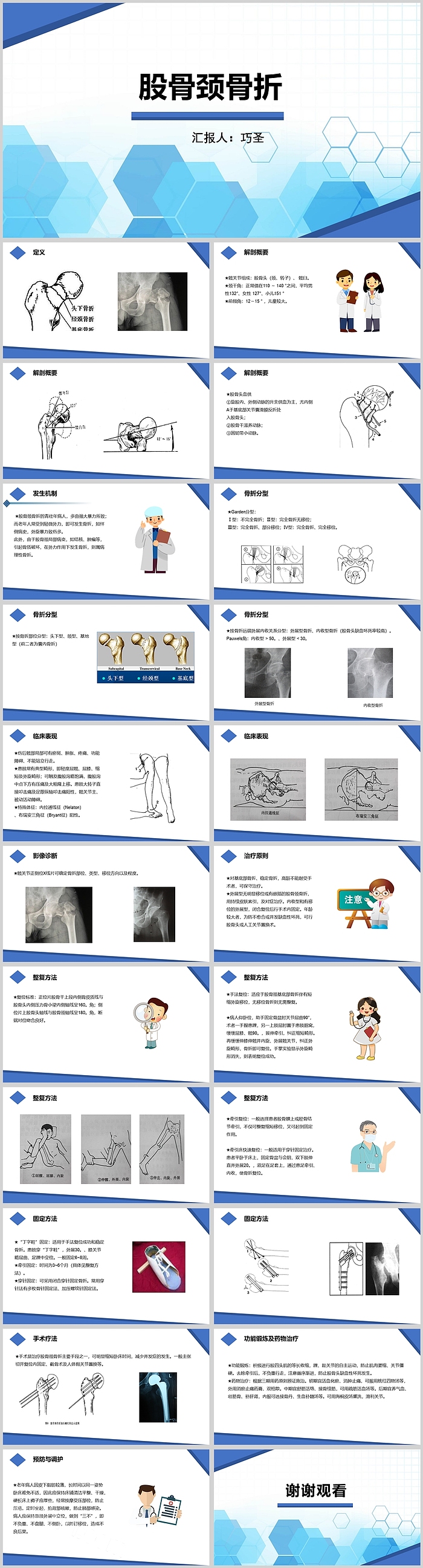 微粒体蓝色渐变股骨颈骨折PPT模板