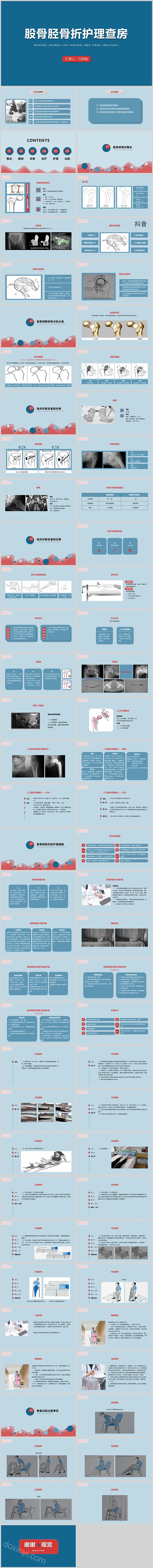 极简风蓝色股骨胫骨折护理查房PPT模板