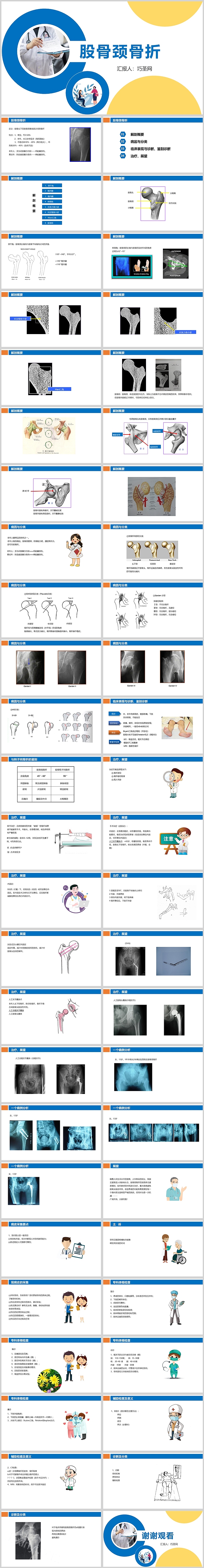 创意精美股骨颈骨折的护理查房PPT模板