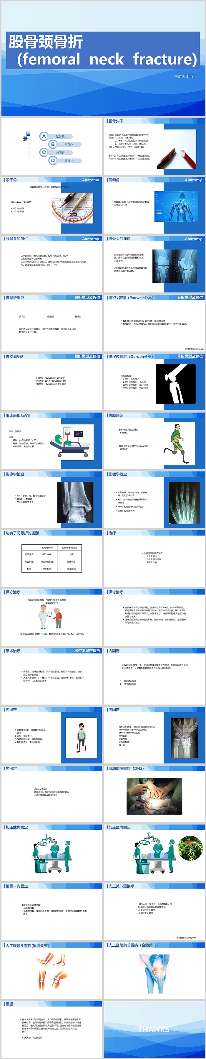 蓝色渐变风创意股骨颈骨折护理查房PPT模板