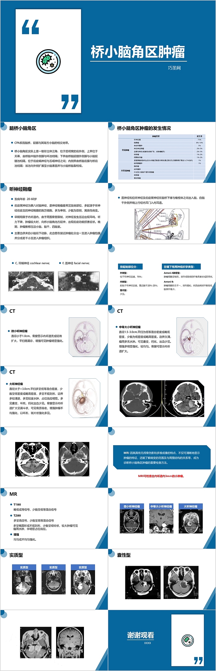 桥小脑角区肿瘤护理查房PPT课件