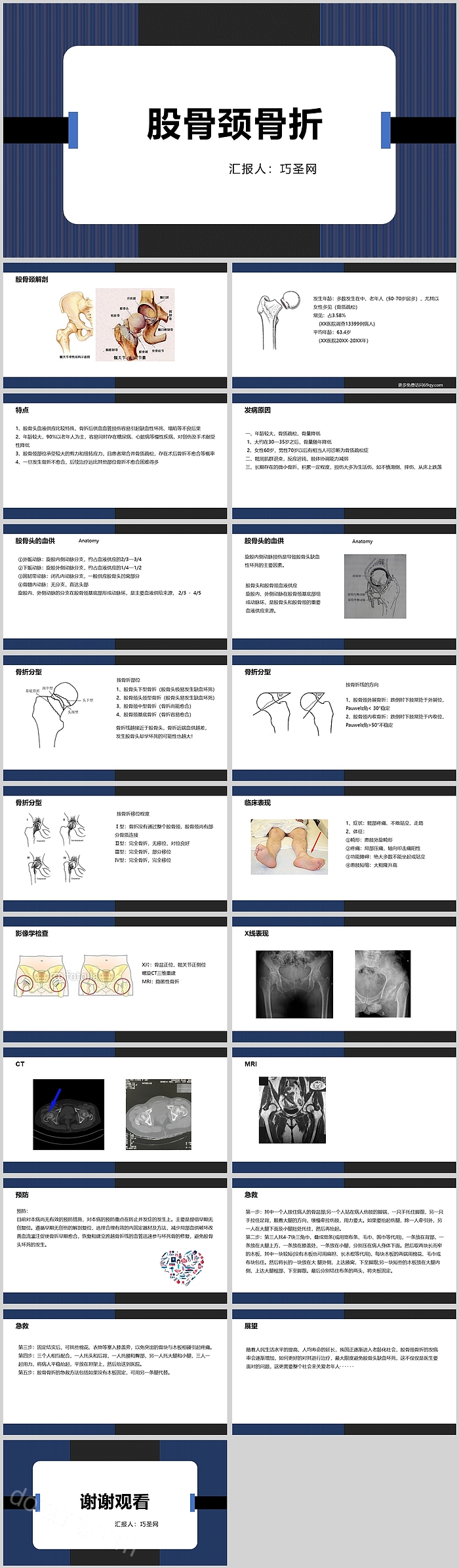 简单内容型股骨颈骨折的护理查房PPT模板